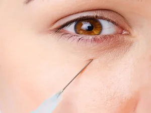 پر کردن گودی زیر چشم
