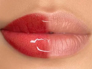 بعد از ژل لب آنتی بیوتیک بخوریم؟